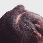 Load and play video in Gallery viewer, Exfoliating Scalp Brush
